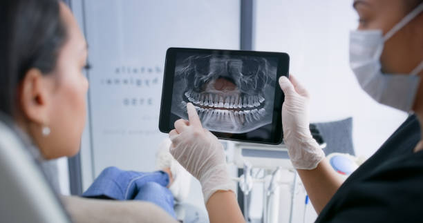 Licensed Teeth Whitening service in Buena Vista, GA - Smile Center Dentistry